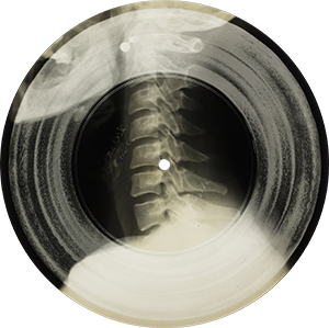 XrayVertebrae